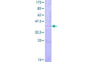 Image no. 1 for ORM1-Like 2 (ORMDL2) (AA 1-153) protein (GST tag) (ABIN1313666)