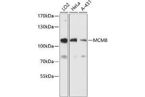 Western blot analysis of extracts of various cell lines, using MCM8 antibody (ABIN6129652, ABIN6143648, ABIN6143649 and ABIN6216734) at 1:3000 dilution.