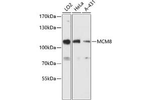 Western blot analysis of extracts of various cell lines, using MCM8 antibody (ABIN6129652, ABIN6143648, ABIN6143649 and ABIN6216734) at 1:3000 dilution. (MCM8 anticorps  (AA 591-840))