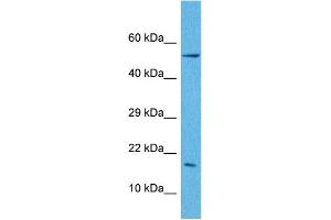 Host:  Rabbit  Target Name:  LEP  Sample Tissue:  Human A549 Whole Cell  Antibody Dilution:  1ug/ml (Leptin anticorps  (N-Term))