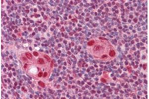 Human Thymus: Formalin-Fixed, Paraffin-Embedded (FFPE)