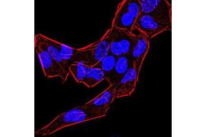 Immunofluorescence analysis of Hela cells using BMP4 mouse mAb. (BMP4 anticorps  (AA 277-408))