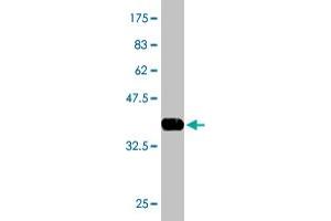 Western Blot detection against Immunogen (37. (CES2 anticorps  (AA 514-621))