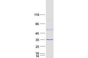 Validation with Western Blot