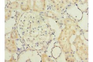 Immunohistochemistry of paraffin-embedded human kidney tissue using ABIN7173115 at dilution of 1:100 (TMEM186 anticorps  (AA 124-213))