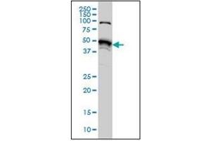 Western Blotting (WB) image for anti-serine/threonine Kinase 38 (STK38) (AA 365-466) antibody (ABIN954986)