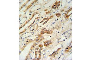 ZFYVE16 Antibody (N-term) (ABIN651313 and ABIN2840182) IHC analysis in formalin fixed and paraffin embedded lung tissue followed by peroxidase conjugation of the secondary antibody and DAB staining. (ZFYVE16 anticorps  (N-Term))
