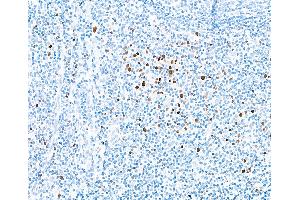 Immunohistochemistry (IHC) image for anti-Eomesodermin (EOMES) (AA 125-175) antibody (ABIN7455149)