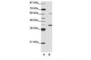 Image no. 1 for anti-Zinc Finger Protein 843 (ZNF843) (AA 41-90) antibody (ABIN6736171) (ZNF843 anticorps  (AA 41-90))