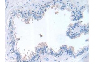 Detection of LIF in Human Prostate Tissue using Polyclonal Antibody to Leukemia Inhibitory Factor (LIF)