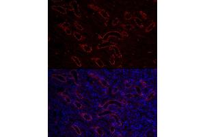 anti-Aquaporin 3 (Gill Blood Group) (AQP3) (AA 178-292) antibody