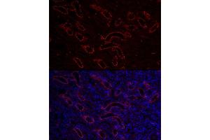 Immunofluorescence analysis of mouse kidney cells using  Rabbit pAb (ABIN3016811, ABIN3016812, ABIN3016813, ABIN1678723 and ABIN6219847) at dilution of 1:150 (40x lens). (AQP3 anticorps  (AA 178-292))