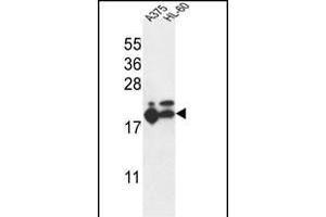 RPL17 Antibody (C-term) (ABIN653848 and ABIN2843111) western blot analysis in ,HL-60 cell line lysates (35 μg/lane). (RPL17 anticorps  (C-Term))