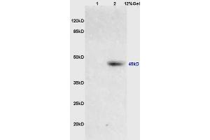 Lane 1: mouse brain lysates Lane 2: human colon carcinoma lysates probed with Anti PIM1(Tyr218) Polyclonal Antibody, Unconjugated (ABIN745058) at 1:200 in 4 °C. (PIM1 anticorps  (pTyr309))
