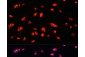Immunofluorescence analysis of U-2 OS cells using ILF3 Polyclonal Antibody at dilution of 1:100. (Interleukin enhancer-binding factor 3 (ILF3) anticorps)