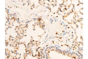 ABIN6267286 at 1/100 staining mouse lung tissue sections by IHC-P. (TRKA anticorps  (pTyr681, Tyr680))