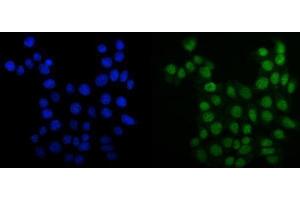 IF analysis of MCM6 using anti-MCM6 antibody (ABIN7600036). (MCM6 anticorps  (AA 14-821))