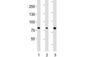 Western blot analysis of lysate from human 1) ovary, 2) placenta and 3) plasma lysate using Integrin beta 8 antibody diluted at 1:1000.