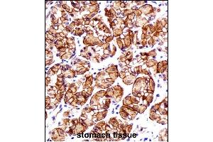 CTNNB1 Antibody (N-term) immunohistochemistry analysis in formalin fixed and paraffin embedded human stomach tissue followed by peroxidase conjugation of the secondary antibody and DAB staining.