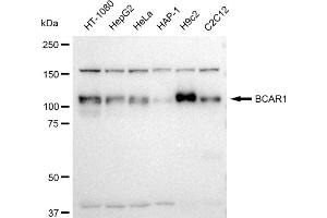 Western blotting analysis using BCAR1 antibody (ABIN7797791).
