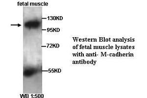 Image no. 2 for anti-M-Cadherin (CDH15) (Internal Region) antibody (ABIN790873) (CDH15 anticorps  (Internal Region))