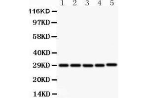 Anti- CD40Lantibody, Western blotting All lanes: Anti CD40L  at 0. (CD40 Ligand anticorps  (N-Term))