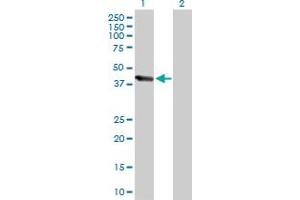 Western Blot analysis of UBE3C expression in transfected 293T cell line by UBE3C MaxPab polyclonal antibody. (UBE3C anticorps  (AA 1-404))