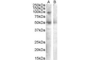 Image no. 1 for anti-Sulfatase 2 (SULF2) (Internal Region) antibody (ABIN375090) (SULF2 anticorps  (Internal Region))