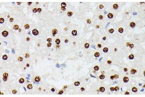 Immunohistochemistry of paraffin-embedded Rat liver using HNRNPD Polyclonal Antibody at dilution of 1:100 (40x lens). (HNRNPD/AUF1 anticorps)
