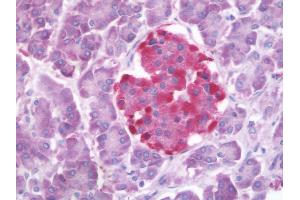 Human Pancreas: Formalin-Fixed, Paraffin-Embedded (FFPE) (GLP1R anticorps  (N-Term))