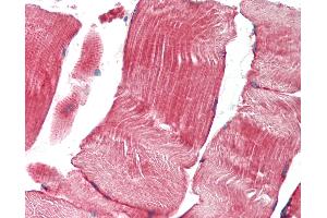 Anti-TNK1 antibody IHC staining of human skeletal muscle. (TNK1 anticorps  (AA 517-566))