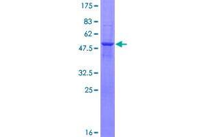 Image no. 1 for Haloacid Dehalogenase-Like Hydrolase Domain Containing 1 (HDHD1) (AA 1-214) protein (GST tag) (ABIN1306484)