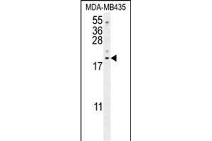 LYRM4 Antibody (Center) (ABIN654638 and ABIN2844335) western blot analysis in MDA-M cell line lysates (35 μg/lane).