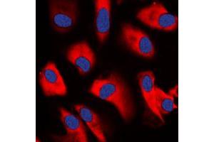 Immunofluorescent analysis of CDC37 staining in K562 cells. (CDC37 anticorps  (Center))