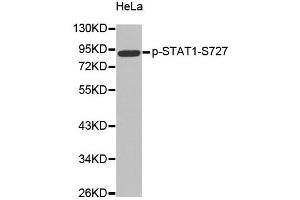 Western Blotting (WB) image for anti-Signal Transducer and Activator of Transcription 1, 91kDa (STAT1) (pSer727) antibody (ABIN1870637) (STAT1 anticorps  (pSer727))