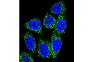 Confocal immunofluorescent analysis of MUTYH Antibody (Center) (ABIN653106 and ABIN2842694) with Hela cell followed by Alexa Fluor® 488-conjugated goat anti-rabbit lgG (green).