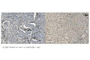 IHC analysis of MCM5 using anti-MCM5 antibody (ABIN7600583). (MCM5 anticorps  (AA 206-723))