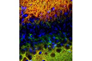 Immunohistochemistry (IHC) image for anti-SynCAM 1/2/3 (AA 436-446) antibody (ABIN1742491) (SynCAM 1/2/3 (AA 436-446) anticorps)