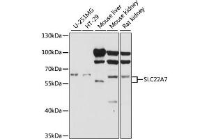 Western blot analysis of extracts of various cell lines, using SLC22A7 antibody. (SLC22A7 anticorps)