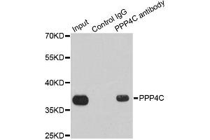 Immunoprecipitation analysis of 200ug extracts of 293T cells using 1ug PPP4C antibody. (PPP4C anticorps)