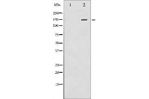 Western blot analysis of iNOS phosphorylation expression in whole cell lysates,The lane on the left is treated with the antigen-specific peptide. (NOS2 anticorps  (pTyr151))