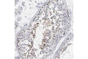 Immunohistochemical staining of human testis with C9orf11 polyclonal antibody  shows strong cytoplasmic positivity in a subset of seminiferus duct cells. (C9orf11 anticorps)