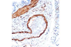 Immunohistochemistry of paraffin-embedded rat lung using α-Actin-1  Rabbit mAb (ABIN1682816, ABIN7101454, ABIN7101455 and ABIN7101456) at dilution of 1:100 (40x lens).