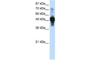 Transfected 293T; WB Suggested Anti-ZNF342 Antibody Titration: 0. (Zinc Finger Protein 296 (ZNF296) (C-Term) anticorps)