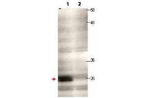 Western blot using  protein A purified anti-CENP-Q antibody shows detection of endogenous CENP-Q in a HeLa whole cell lysate (lane 1, arrowhead). (CENPQ anticorps)