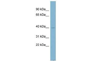 NDUFA9 antibody used at 1 ug/ml to detect target protein. (NDUFA9 anticorps)