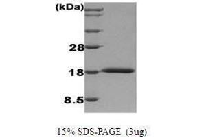Figure annotation denotes ug of protein loaded and % gel used. (IFNA1 Protéine)