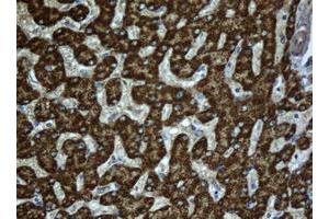 Immunohistochemistry (IHC) image for anti-Acyl-CoA Dehydrogenase, C-2 To C-3 Short Chain (Acads) (AA 34-260) antibody (ABIN1491430)