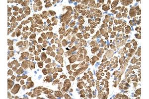 Tropomyosin 2 antibody was used for immunohistochemistry at a concentration of 4-8 ug/ml to stain Skeletal muscle cells (arrows) in Human Muscle. (TPM2 anticorps)