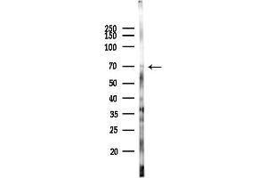 anti-Interleukin 2 Receptor, beta (IL2RB) (pTyr364) antibody